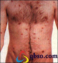 �𷨾���һ��ͬ�����İ��̲�����