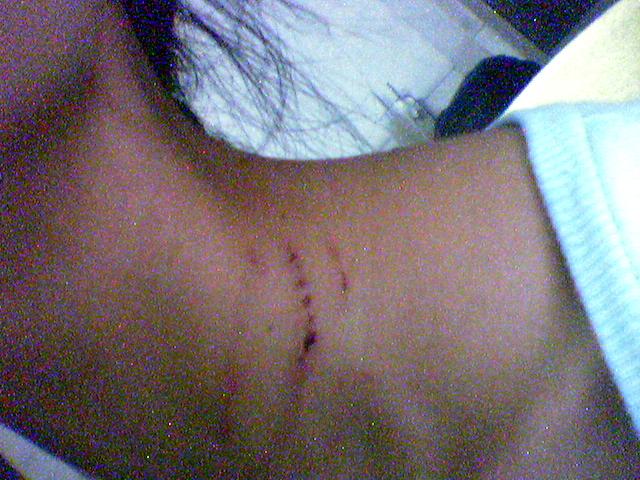 ���Ѿ����������ѽ���ʱ������Ӧ����ô�죿