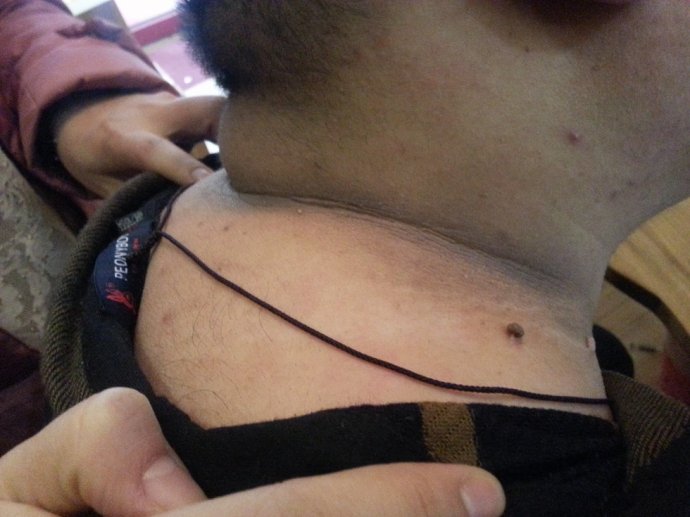 ǰ�������ֺ�������ͷ�����������Ͼ�����һȦ��ӡ��