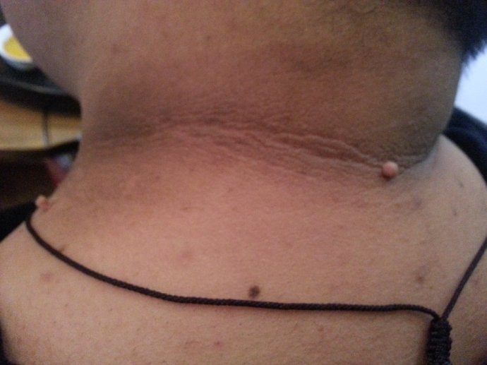 ǰ�������ֺ�������ͷ�����������Ͼ�����һȦ��ӡ��