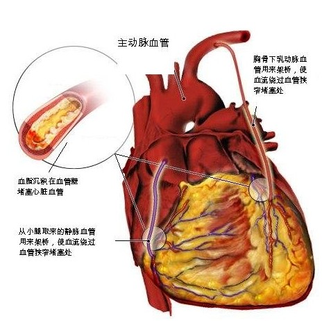 �������˽�30���ľ����������׾��