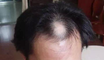 ������60��ֱ�ӱ��ߺ��������