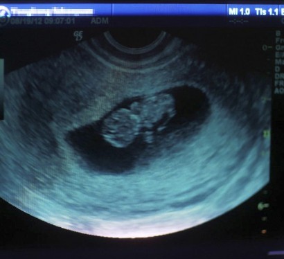 ҽԺ10����8��������_ŮԺ��ʹ��������_��������(ͼ)