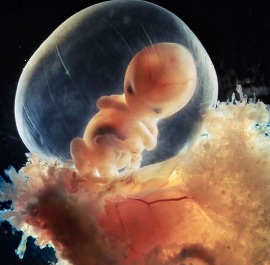 做人流时,胎儿的感受是怎样的? 做人流时,胎儿的感受是怎样的?