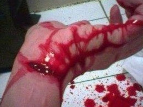 17岁的高考尖子生割腕自杀何处喊冤?现世邪淫果报 17岁的高考尖子生割腕自杀何处喊冤?现世邪淫果报