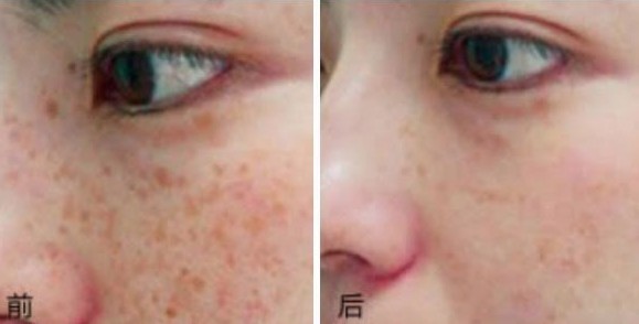 ֻҪ����������ˮ�����һ���£�������ȸ��ͨͨ�����ˡ�