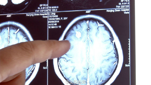 佛说杀生食肉者,常受短命多病身(附惨烈实例) 佛说杀生食肉者,常受短命多病身(附惨烈实例)