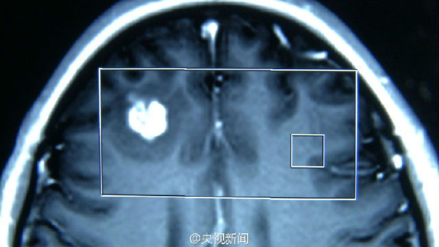 佛说杀生食肉者,常受短命多病身(附惨烈实例) 佛说杀生食肉者,常受短命多病身(附惨烈实例)