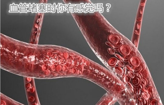 Ѫ�ܶ���ʱ���ио���