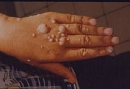 戒邪淫真实有效的方法 戒邪淫真实有效的方法