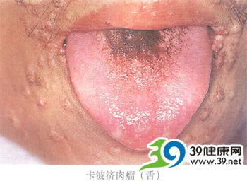 ��а����ʵ��Ч�ķ���