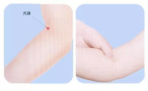 �����Ѩλ�൱�ڳ���ζ�ػ��裬�����޽��ɣ�