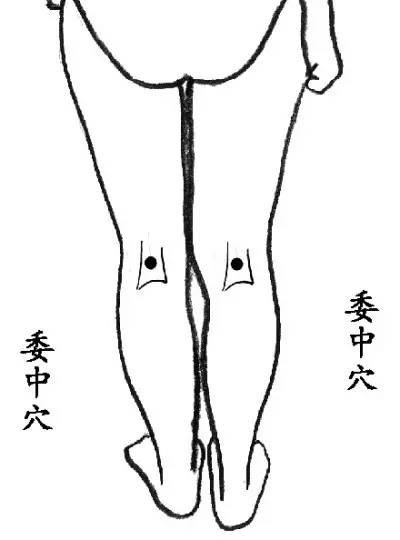 �ҵ��⼸��Ѩλ��ʹ���򡱣������ͳɹ���һ��