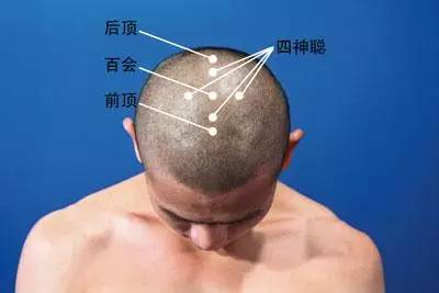 ��Ѩλ���롷�ٻ�ͨ�졢ӿȪͨ�أ����͹���