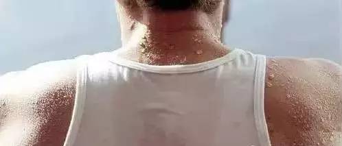 汗从哪里出,病从哪里来,绝对神奇 汗从哪里出,病从哪里来,绝对神奇