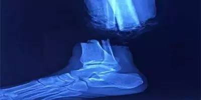 连续37年的杀生,储存的恶报业障来了,不折不扣的因果循环!! 连续37年的杀生,储存的恶报业障来了,不折不扣的因果循环!!