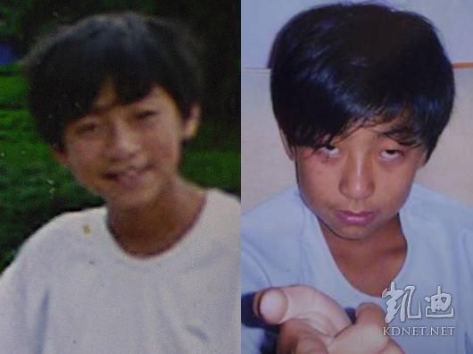 ���ϰ�֢�������_���������ǲ���ңԶ(��ͼ)