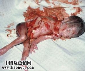 ��̥̥����ʵ��Ƭ����С�����ಡ���룡��