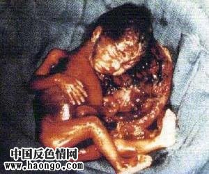 打胎胎儿真实照片(胆小,心脏病勿入!) 打胎胎儿真实照片(胆小,心脏病勿入!)