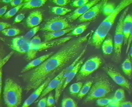 生病,是細胞在喊救命(如何将癌细胞变回成正常的细胞) 生病,是細胞在喊救命(如何将癌细胞变回成正常的细胞)