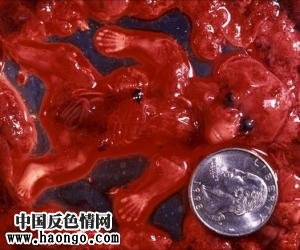 打胎胎儿真实照片(胆小,心脏病勿入!) 打胎胎儿真实照片(胆小,心脏病勿入!)