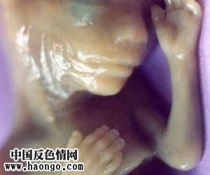 打胎胎儿真实照片(胆小,心脏病勿入!) 打胎胎儿真实照片(胆小,心脏病勿入!)