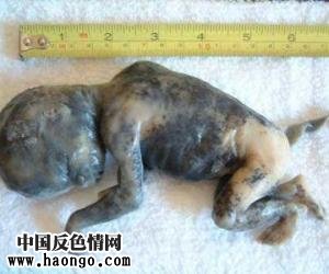 打胎胎儿真实照片(胆小,心脏病勿入!) 打胎胎儿真实照片(胆小,心脏病勿入!)