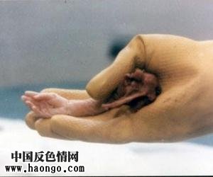打胎胎儿真实照片(胆小,心脏病勿入!) 打胎胎儿真实照片(胆小,心脏病勿入!)