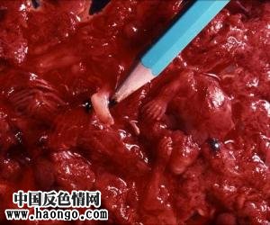 打胎胎儿真实照片(胆小,心脏病勿入!) 打胎胎儿真实照片(胆小,心脏病勿入!)