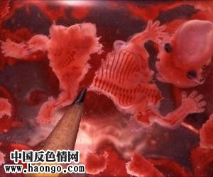 打胎胎儿真实照片(胆小,心脏病勿入!) 打胎胎儿真实照片(胆小,心脏病勿入!)