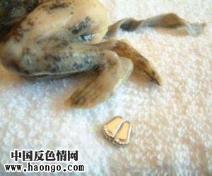 打胎胎儿真实照片(胆小,心脏病勿入!) 打胎胎儿真实照片(胆小,心脏病勿入!)