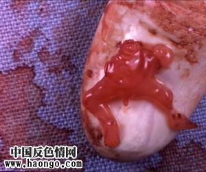 打胎胎儿真实照片(胆小,心脏病勿入!) 打胎胎儿真实照片(胆小,心脏病勿入!)