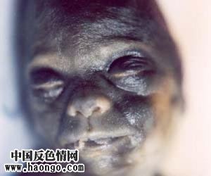 打胎胎儿真实照片(胆小,心脏病勿入!) 打胎胎儿真实照片(胆小,心脏病勿入!)