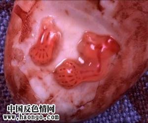 打胎胎儿真实照片(胆小,心脏病勿入!) 打胎胎儿真实照片(胆小,心脏病勿入!)