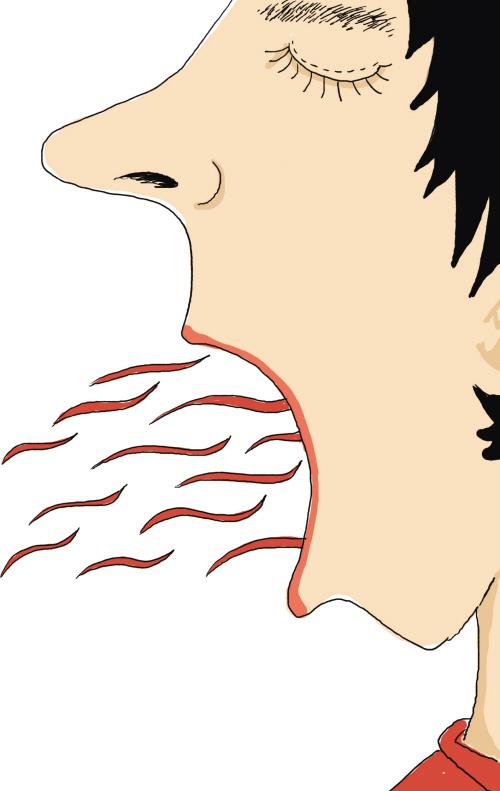 口臭透露出来的癌症信号 口臭透露出来的癌症信号