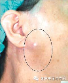 ���ӱ������������ֻ�����һ��Ҫ��