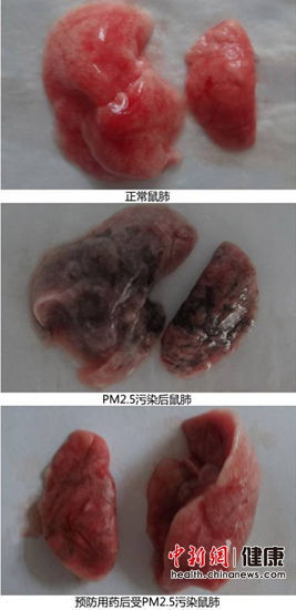 复旦大学研究:雾霾使鲜肺6天变黑肺 无法逆转(图)