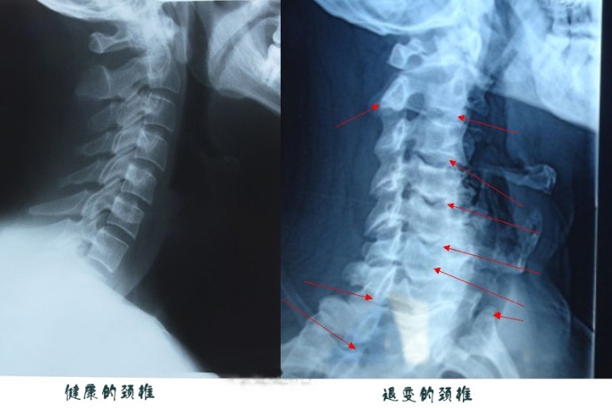 35�����Ӵ���һ��������˥�ϳ�70����ͷ������Ů�˴���ҪС�İ�������