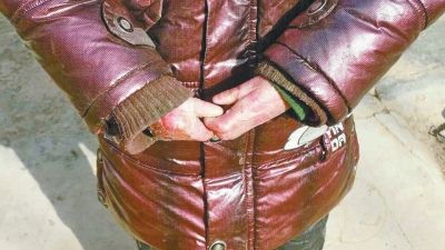 ����8����ͯ�������� ȫ��Ƥ��һ����������(ͼ)