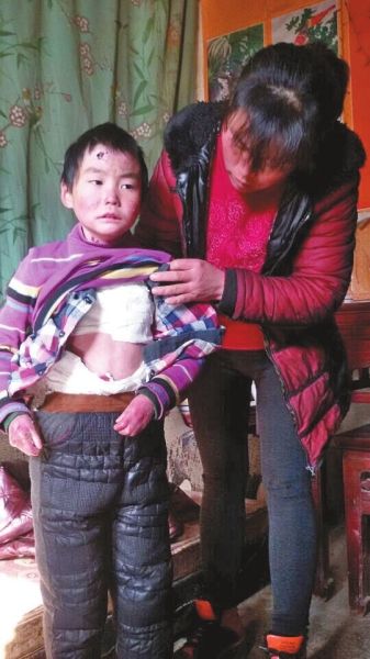 ����8����ͯ�������� ȫ��Ƥ��һ����������(ͼ)