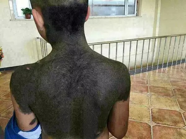 六道轮回真是不虚——“猪皮人身”的孩子! 六道轮回真是不虚——“猪皮人身”的孩子!