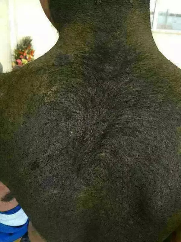 六道轮回真是不虚——“猪皮人身”的孩子! 六道轮回真是不虚——“猪皮人身”的孩子!