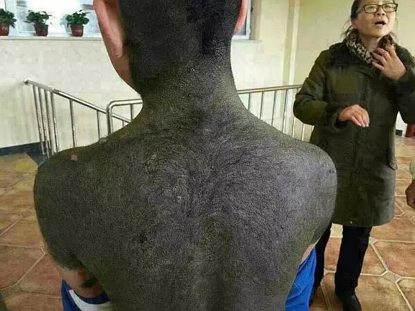 六道轮回真是不虚——“猪皮人身”的孩子! 六道轮回真是不虚——“猪皮人身”的孩子!