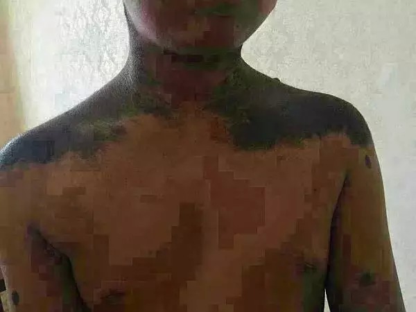 六道轮回真是不虚——“猪皮人身”的孩子! 六道轮回真是不虚——“猪皮人身”的孩子!