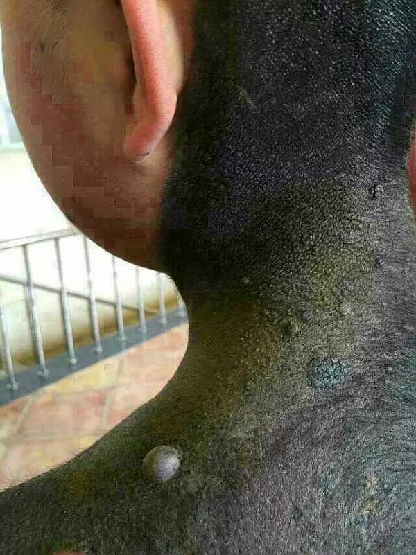 六道轮回真是不虚——“猪皮人身”的孩子! 六道轮回真是不虚——“猪皮人身”的孩子!