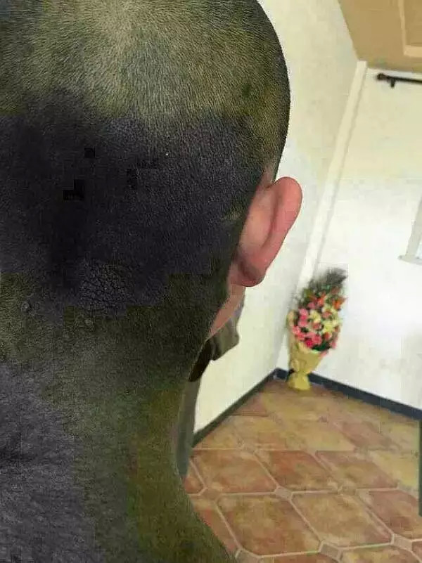 六道轮回真是不虚——“猪皮人身”的孩子! 六道轮回真是不虚——“猪皮人身”的孩子!