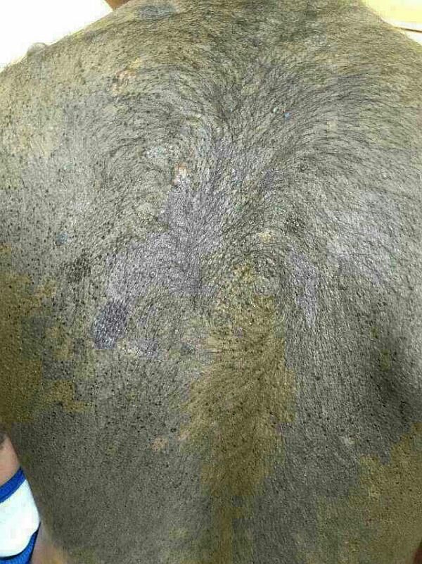 六道轮回真是不虚——“猪皮人身”的孩子! 六道轮回真是不虚——“猪皮人身”的孩子!