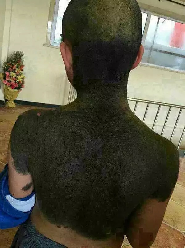 六道轮回真是不虚——“猪皮人身”的孩子! 六道轮回真是不虚——“猪皮人身”的孩子!