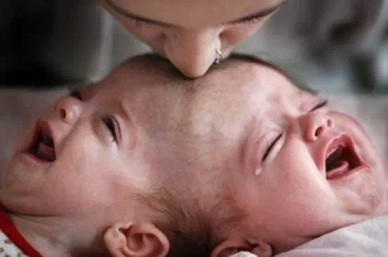 全球奇特的连体人!你一定没见过! 全球奇特的连体人!你一定没见过!