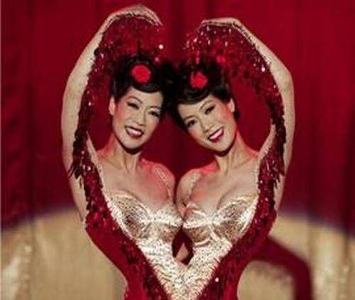 全球奇特的连体人!你一定没见过! 全球奇特的连体人!你一定没见过!